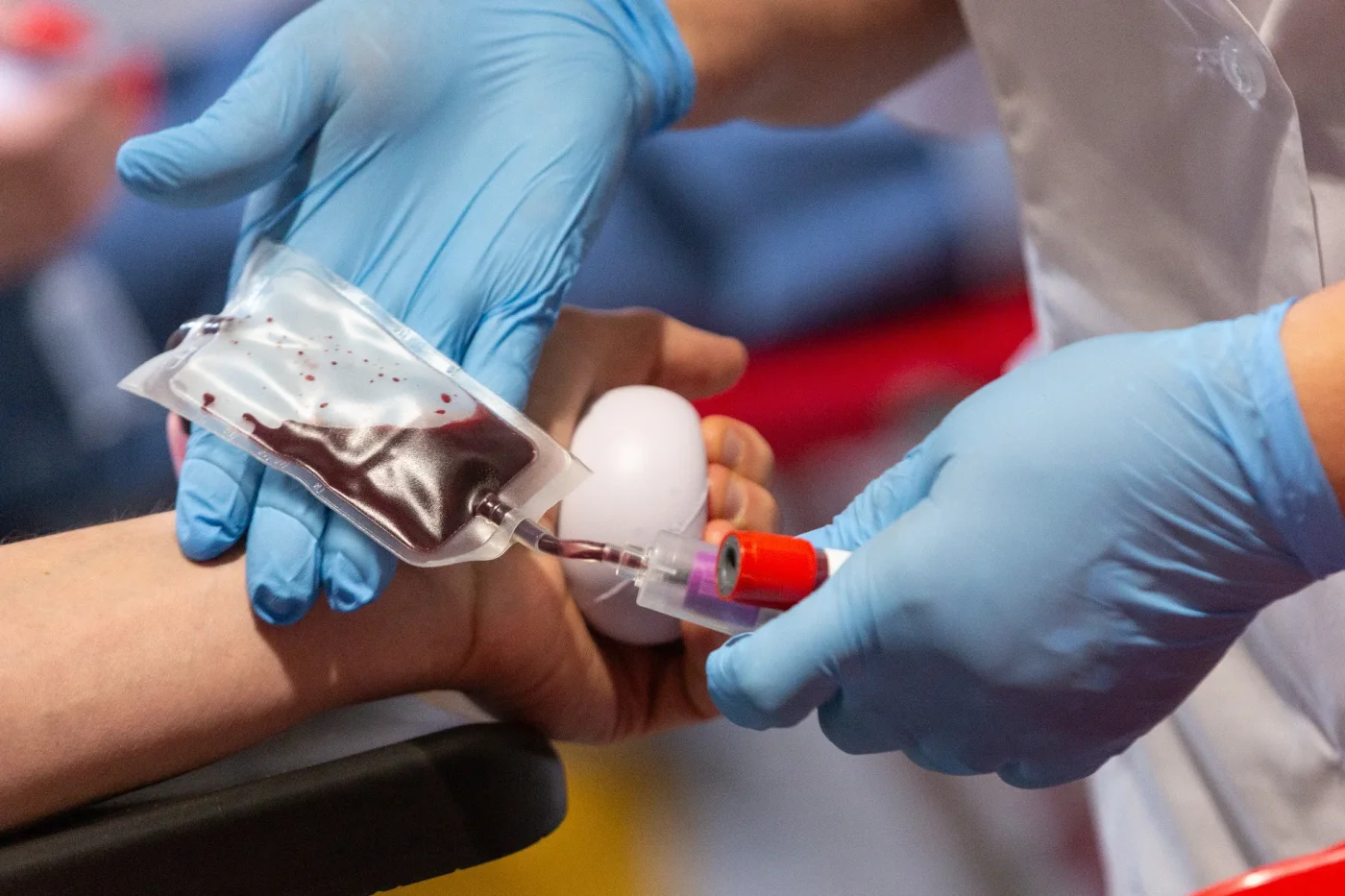 Bolsa de sangre durante una donación
